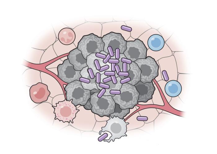 Las células bacterianas modificadas (violeta) activan varias partes del sistema inmunológico para atacar las células tumorales (gris). (Universidad de Columbia)