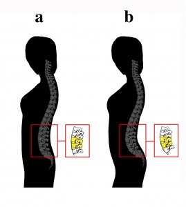 Curvatura lumbar femenina